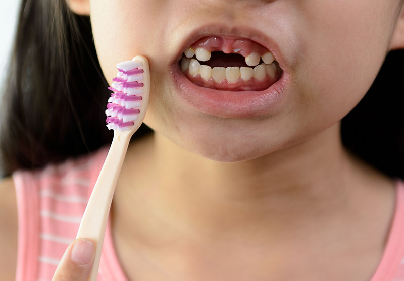dental-trauma-tad