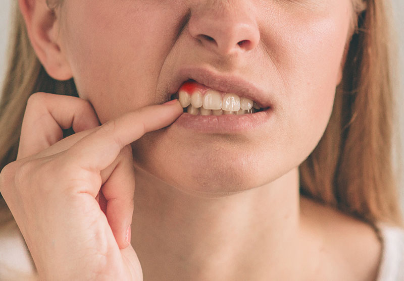 gum-disease