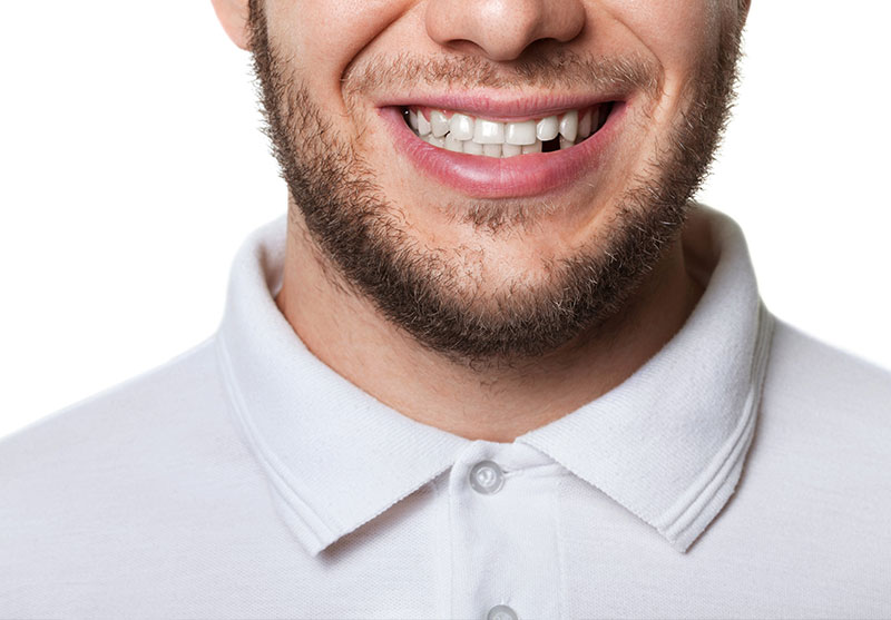 missing-teeth