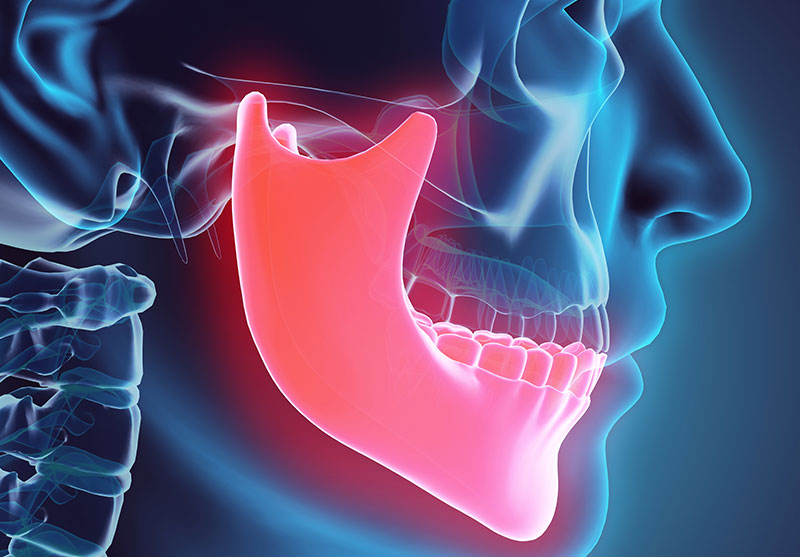 Bruxism (Grinding) & TMD