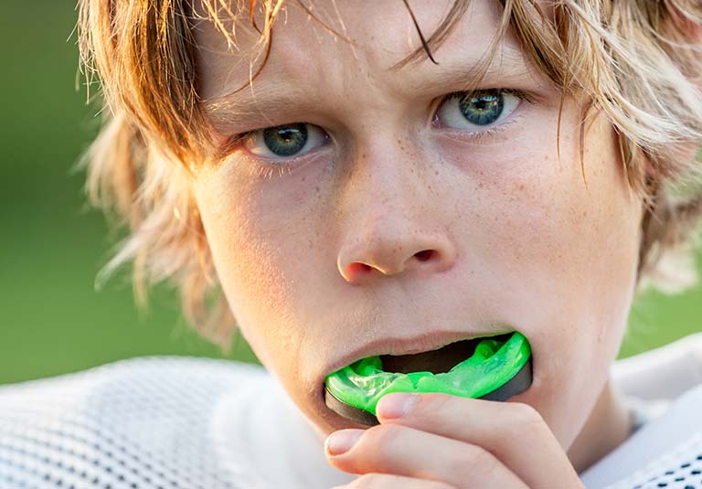 Mouth-Guards