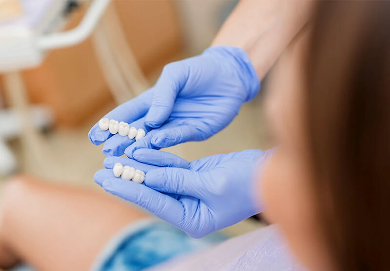 Dental Bridges Toowoomba & Pittsworth - The Avenue Dental